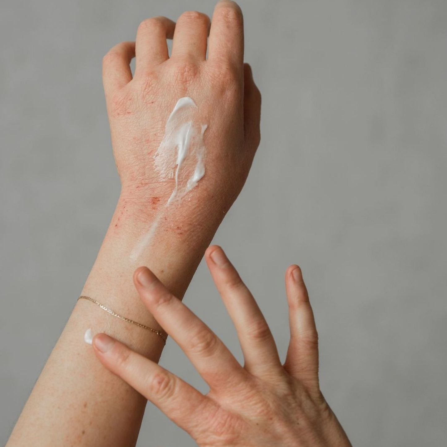 Overnight Eczema Relief Balm